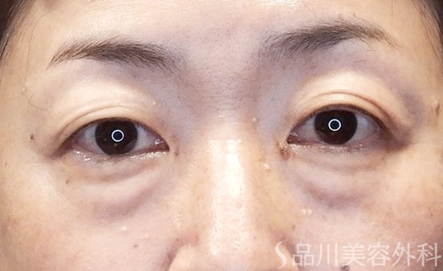 症例NO.65034のBEFORE写真