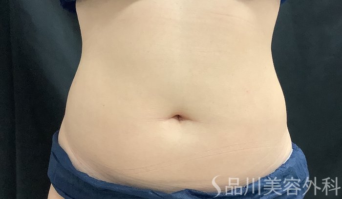 症例NO.68158のBEFORE写真