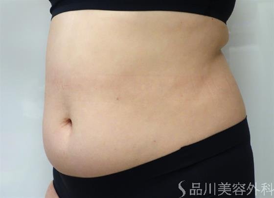 症例NO.40653のBEFORE写真