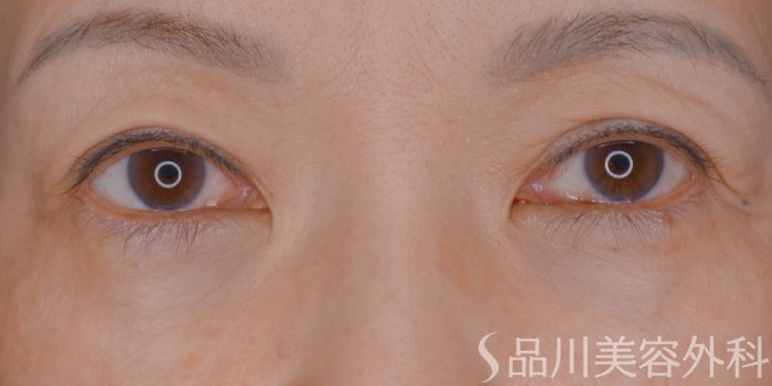 症例NO.73620のAFTER写真