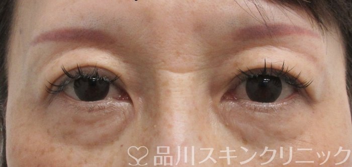 症例NO.67814のAFTER写真