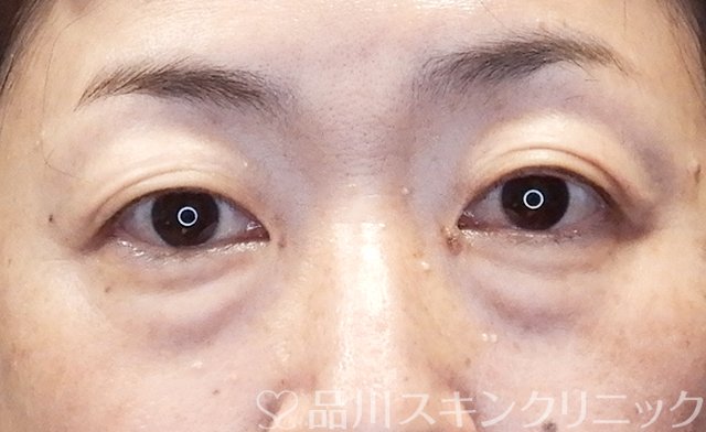 症例NO.65034のBEFORE写真