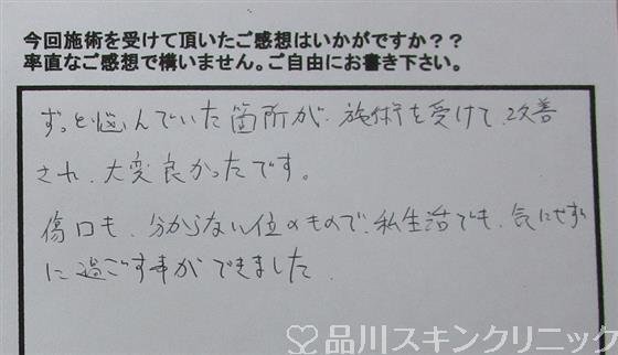 症例NO.33447のAFTER写真
