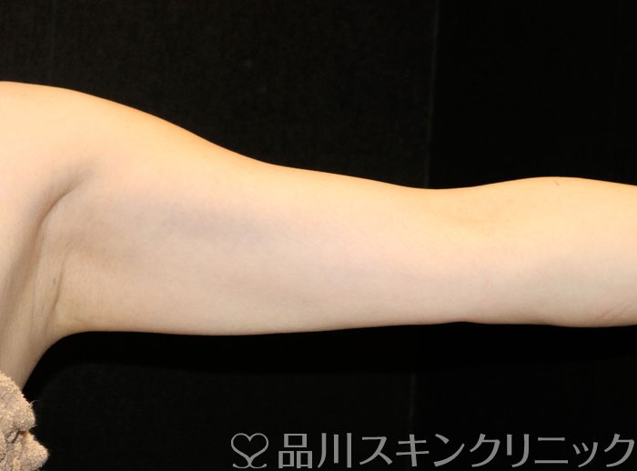 症例NO.73816のAFTER写真