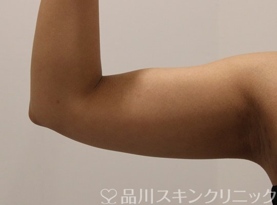 症例NO.67596のAFTER写真