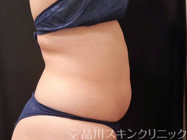 症例NO.68926のBEFORE写真