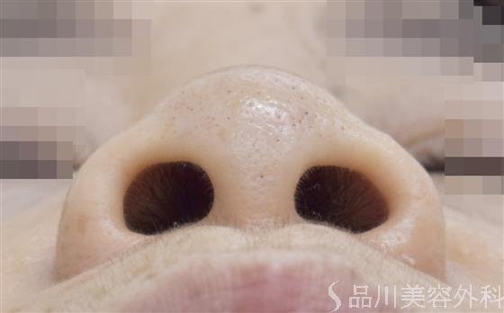 症例NO.48901のBEFORE写真