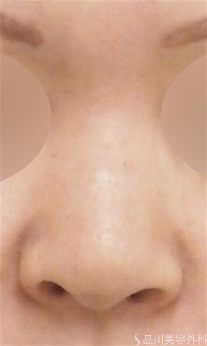 症例NO.20156のBEFORE写真