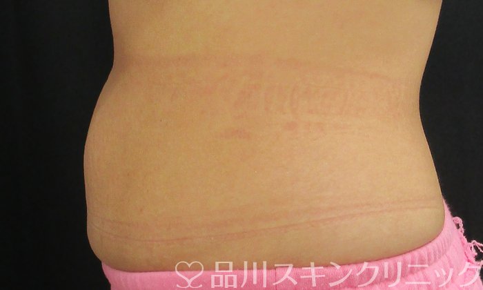 症例NO.74659のAFTER写真
