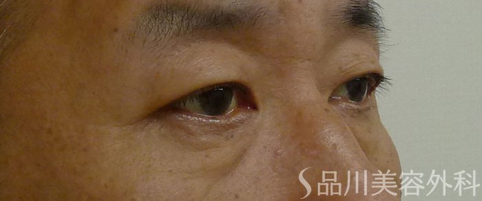 症例NO.72159のBEFORE写真