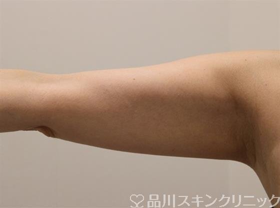 症例NO.46986のBEFORE写真