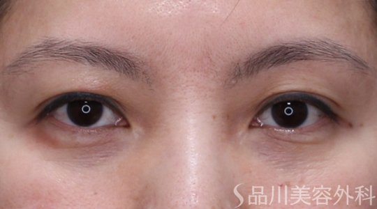症例NO.71037のBEFORE写真