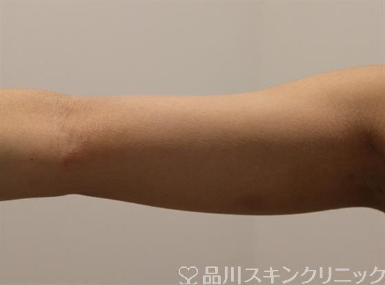 症例NO.47129のBEFORE写真