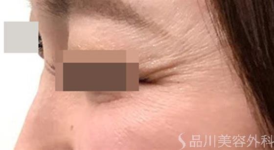 症例NO.47157のBEFORE写真