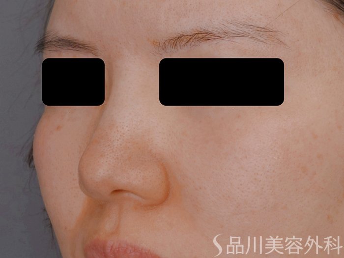 症例NO.73567のBEFORE写真