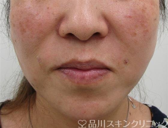 症例NO.36119のAFTER写真
