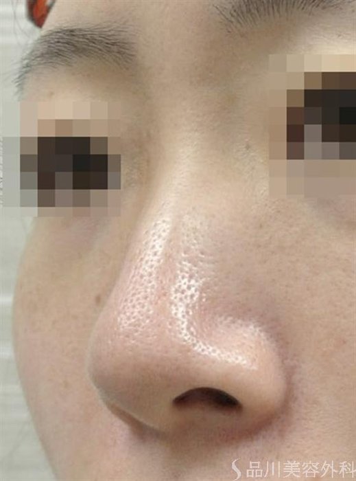 症例NO.16427のBEFORE写真