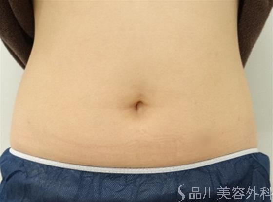 症例NO.22682のAFTER写真