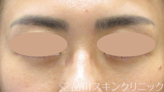症例NO.73843のAFTER写真