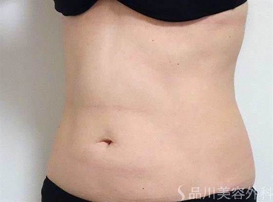 症例NO.25234のBEFORE写真