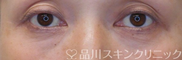 症例NO.71305のAFTER写真