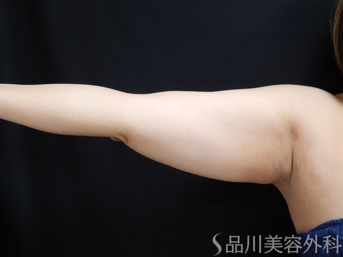 症例NO.70469のBEFORE写真