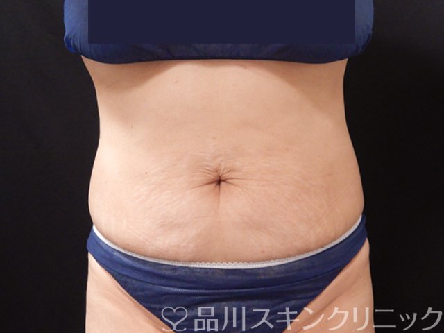 症例NO.68086のAFTER写真