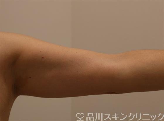 症例NO.40831のBEFORE写真