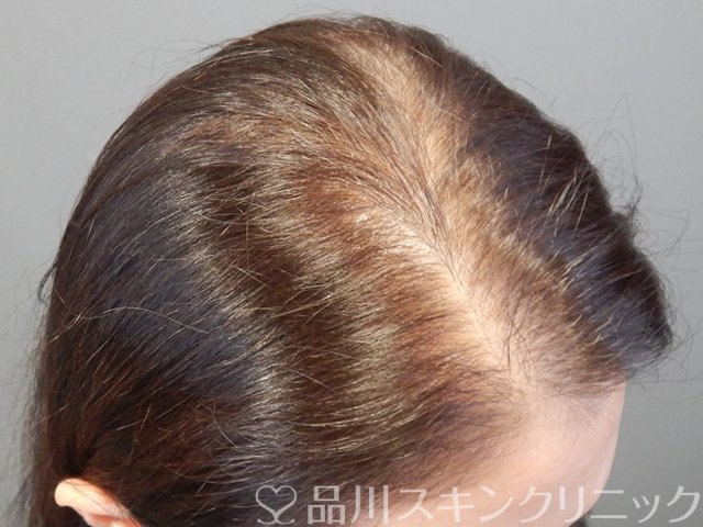 症例NO.68636のBEFORE写真
