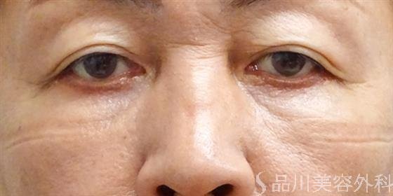 症例NO.49748のAFTER写真