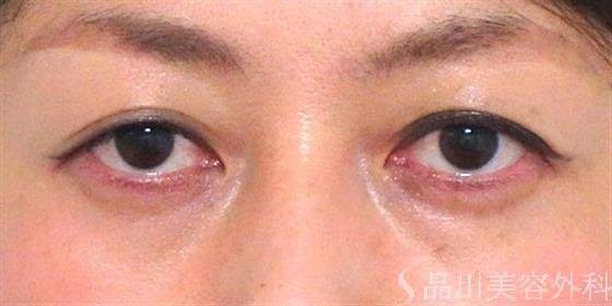 症例NO.20836のBEFORE写真