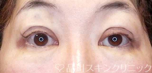 症例NO.67657のAFTER写真