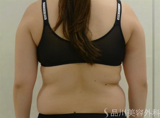 症例NO.43173のBEFORE写真