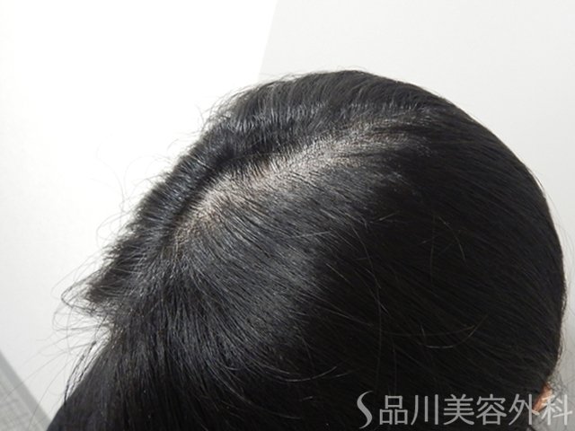 症例NO.73284のBEFORE写真