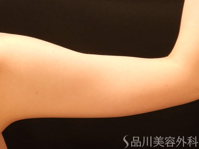 症例NO.67663のBEFORE写真