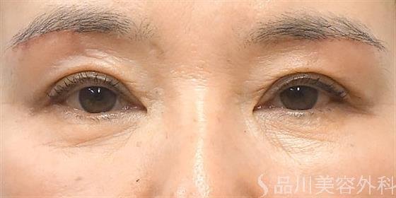 症例NO.21037のAFTER写真