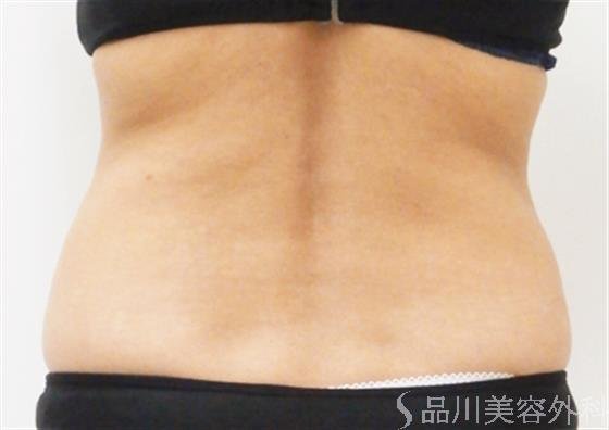 症例NO.20713のBEFORE写真