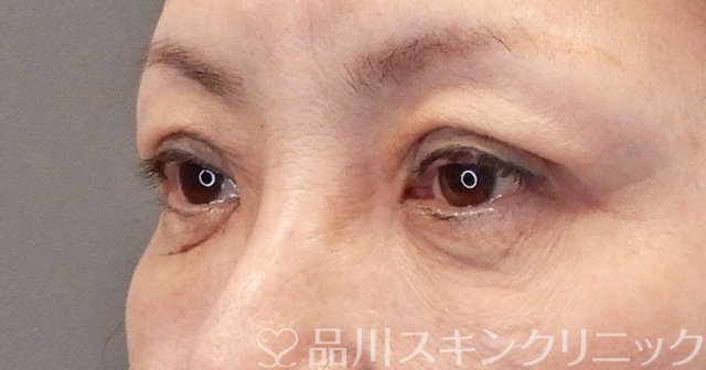 症例NO.65484のAFTER写真