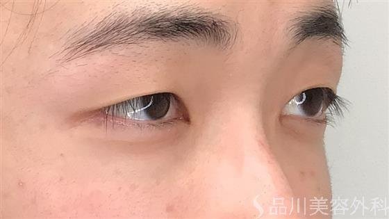 症例NO.60009のBEFORE写真