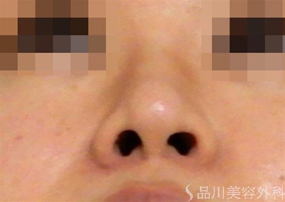 症例NO.37460のAFTER写真
