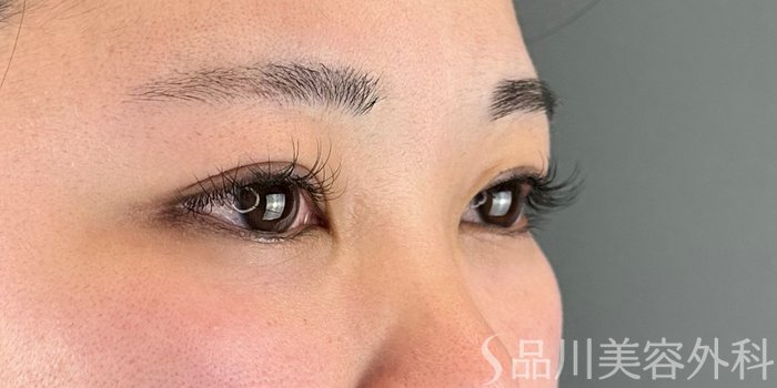 症例NO.70182のBEFORE写真