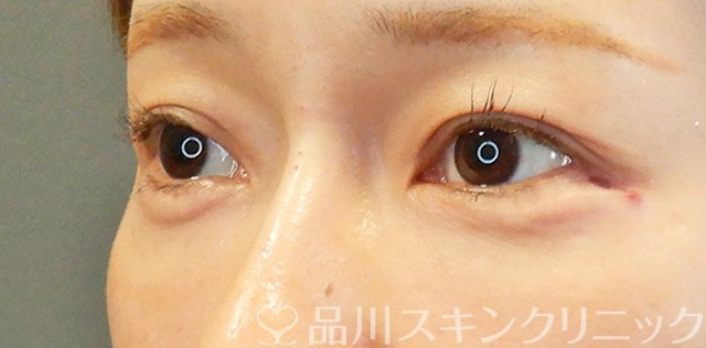 症例NO.67709のAFTER写真