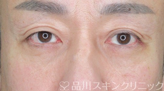 症例NO.69202のAFTER写真