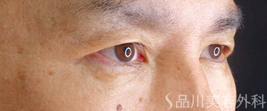 症例NO.66821のBEFORE写真