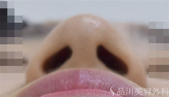 症例NO.47154のBEFORE写真