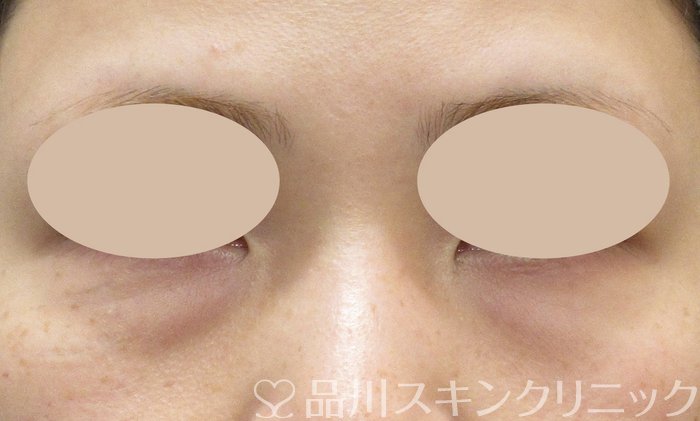 症例NO.73797のBEFORE写真