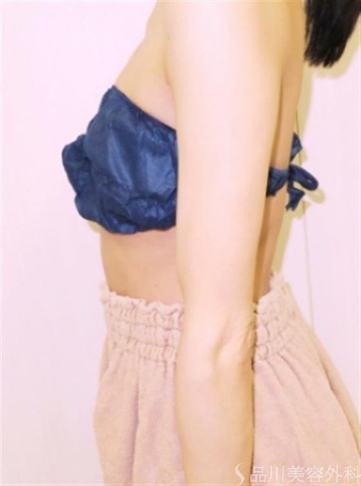 症例NO.41077のBEFORE写真
