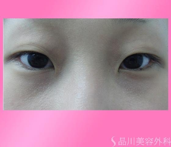 症例NO.7134のBEFORE写真
