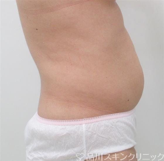 症例NO.27605のBEFORE写真