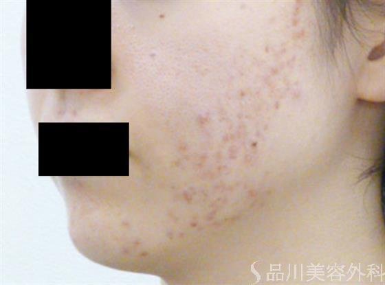 症例NO.24284のBEFORE写真
